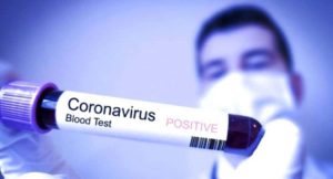 Deteksi Virus Corona dari Minggu Pertama